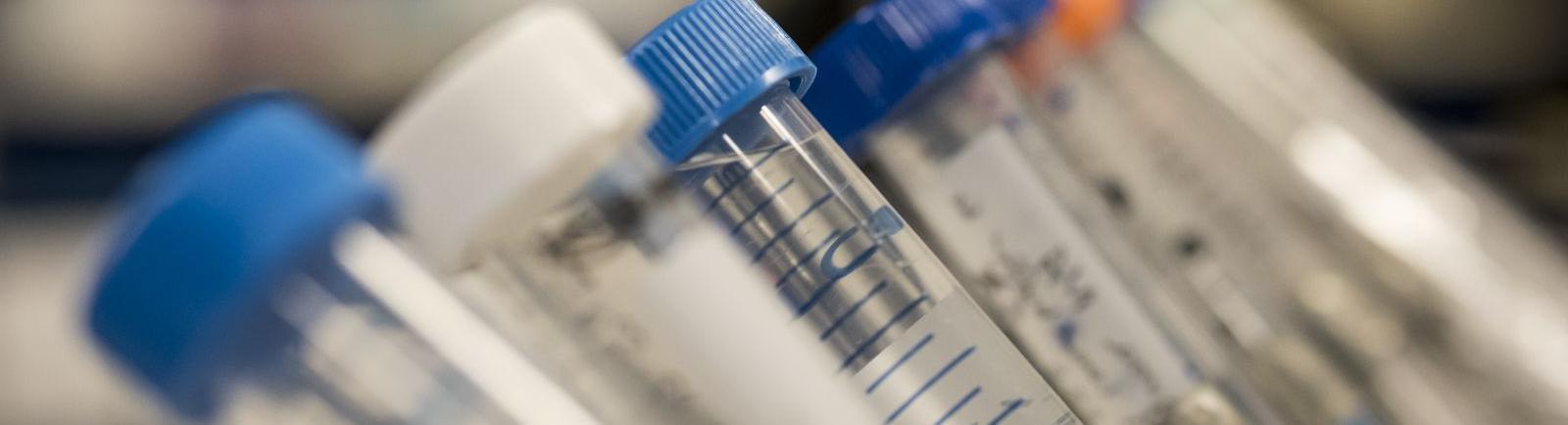 Test tubes in a biochemistry lab